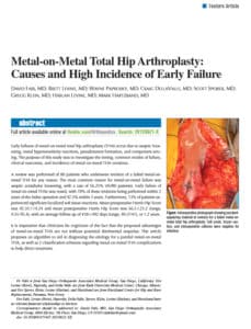 metal on metal total hip replacement