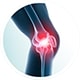joint replacement img services