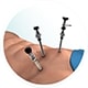 minimally invasive surgery img services